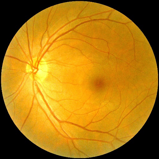 General fundus Test